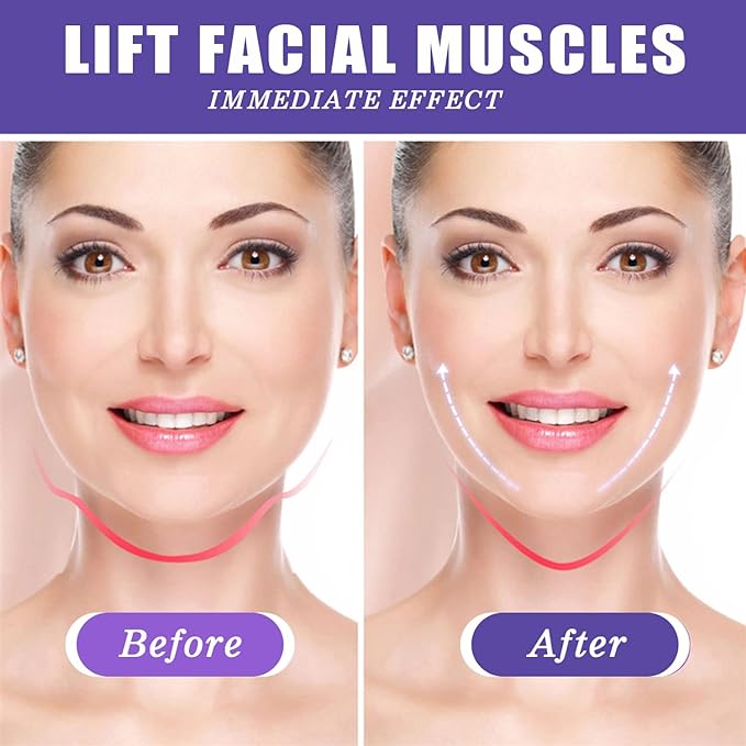 ¡NUEVA CINTA PARA LIFTING FACIAL!